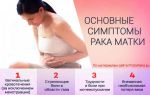 Карцинома матки: симптомы, причины, лечение, прогноз