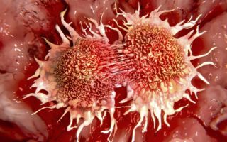 Что убивает раковые клетки?