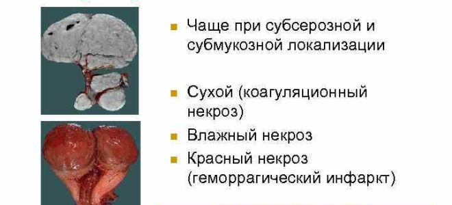 Некроз миомы – что это такое? чем опасно?