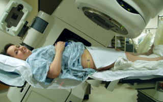 Рак матки – облучение и его последствия