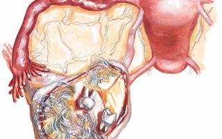 Тератома яичника: чем опасна? удаление и прогноз