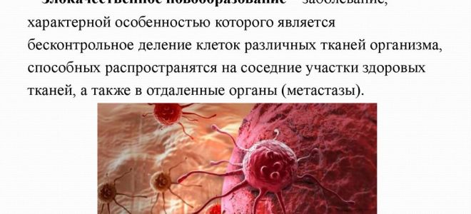 Развитие рака: как и с чего начинается рак?