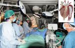 Лечение рака щитовидной железы в израиле