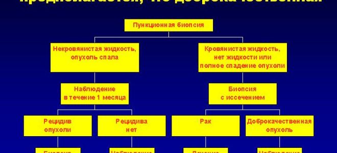 Доброкачественная опухоль молочной железы