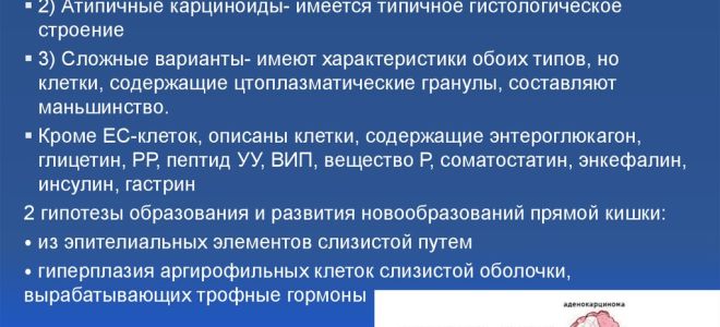Опухоль на ноге как признак рака