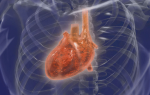 Метастазы в сердце: прогноз и фото