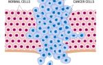 Деление раковых клеток: как происходит?