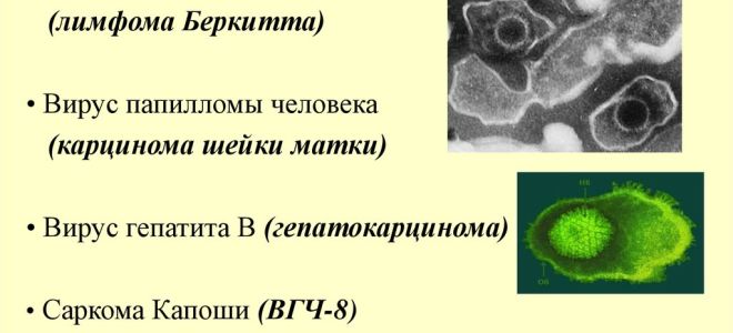 Рак печени с метастазами: сколько живут?